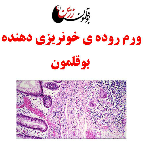ورم روده ی خونریزی دهنده بوقلمون (آنتریت هموراژیک)
